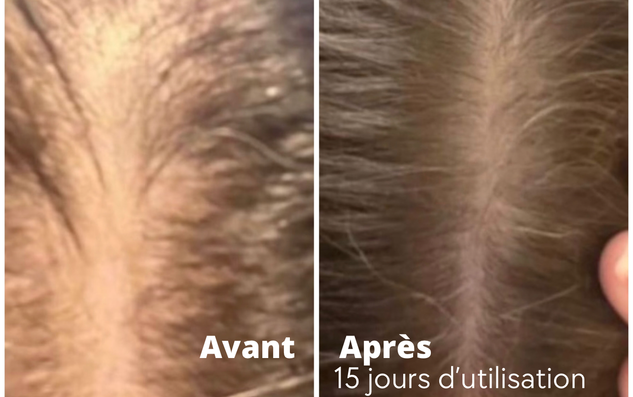 Bpousse Originale